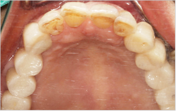 after image