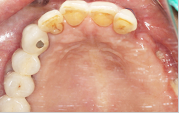 before image
