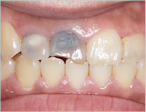 before image