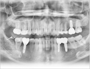 after image