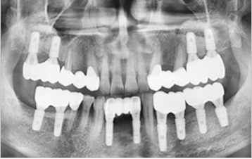 after image